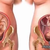 Gebelikte kızamıkçık enfeksiyonu - rubella