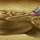 Alzheimer ve tms tedavisi