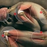 Bel fıtığı nedir ? Nedenleri nelerdir?