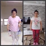 Obezite ameliyatı sonrası yaşam