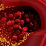 İyi ve kötü kolestrol nedir?