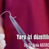 Yara izi düzeltilmesi
