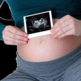 18 ve 23.gebelik haftasında detaylı ultrason
