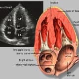 Fetal EKO