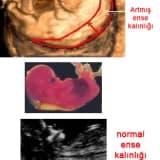 İkili Test - Ense Kalınlığı Ölçümü