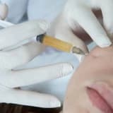 PRP (Platelet Rich Plasma),