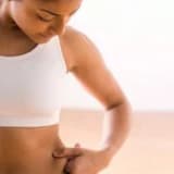 Karın Germe (Abdominoplasti) Ameliyatı Nedir?