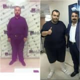 Bariatrik Cerrahi Sonrası Dumping Sendromu Ve Beslenme Önerileri