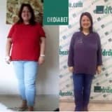 Obezite Cerrahisi Sonrası Yaşanabilecek Sorunlar