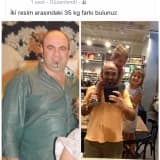 Obezite Hastalığı Ve Sosyal Destek