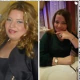Obezite Cerrahisi Sonrası Ne Kadar Zayıflayacağım?
