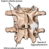 priformis sendromu bel fıtıgı ile karıştıralabilir.