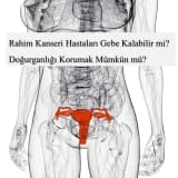 Rahim Kanseri Hastaları Gebe Kalabilir mi? Doğurganlığı Korumak Mümkün mü?