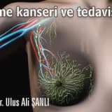 Meme kanseri ve tedavisi