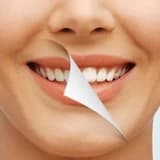 Gülüş Tasarımı Nedir? Nasıl Yapılır?
