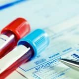 HIV VE ROMATİZMAL HASTALIKLAR