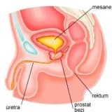 Prostat Hastalıkları Nelerdir?