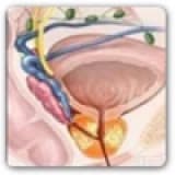 Prostat Kanseri ve Sebepleri nedir? Risk Faktörleri Nelerdir?