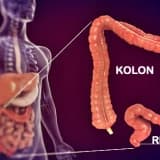 Kolonoskopi nedir?