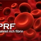 Prf Uygulaması