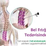Bel Fıtığında Endoskopik Yöntem