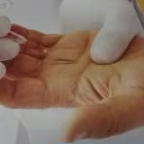 Parmakta tetiklenme nedir?