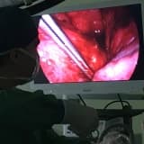 Video Yardımlı Torakoskopik Cerrahi (VATS) Nedir ?