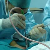 Mediastinal kitleler