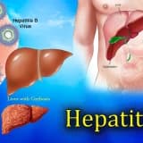 Sinsi Bir Hastalık Hepatitler  Siz de Hepatit Hastası mısınız?