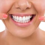 Diş Beyazlatma (Bleaching) ile ilgili en çok sorulan sorular