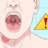 Pediatrik Ses Bozuklukları