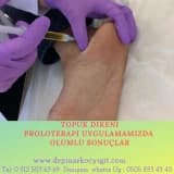Topuk Dikeninde Yüz Güldüren Yeni Nesil Tedaviler