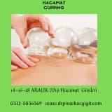HACAMAT ÖNCESİ ve SONRASI DİKKAT EDİLMESİ GEREKEN HUSUSLAR