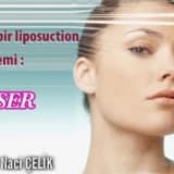 Yeni bir liposuction yöntemi : vaser