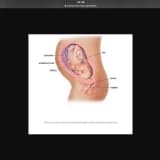 Kısırlık hakkında genel bilgiler