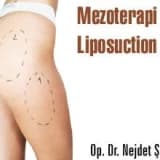 Mezoterapi mi liposuction mı?
