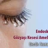 Endoskopik gözyaşı kesesi ameliyatı