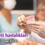 Dişeti hastalıkları(periodontal hastalıklar)