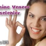 Lamine veneer porselenler