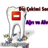 Diş çekimi sonrası ağrı ve alveolit