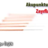 Akupunktur ile zayıflama