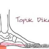 Topuk dikeni,