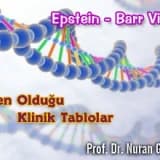 Epstein - Barr Virüsü ve Neden Olduğu Klinik Tablolar