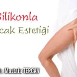 Silikonla bacak estetiği