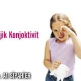 Allerjik konjoktivit