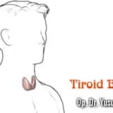 Tiroid bezi ne zaman normal değildir ?