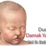 Dudak-Damak Yarığı ile Doğmuş Çocuklarda