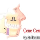 Çene cerrahisi
