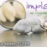 İmplant ve Uygulamaları