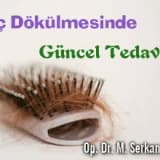 Saç dökülmesinde güncel tedaviler